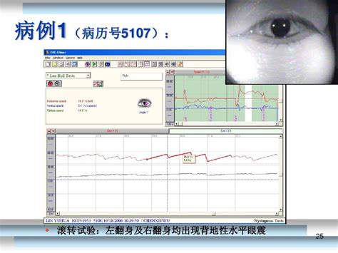 位置性眩晕的诊断与治疗 讲课资料070711word文档在线阅读与下载无忧文档