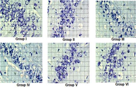 Photomicrographs showing hippocampal pyramidal cells in CA3 region with ... 