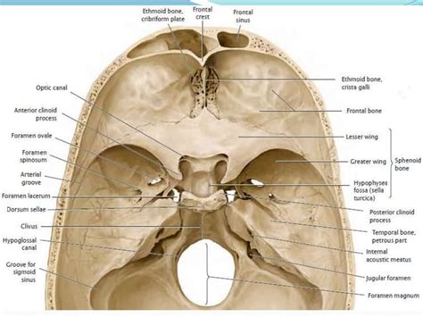 Sphenoid Sinus And Optic Nerve