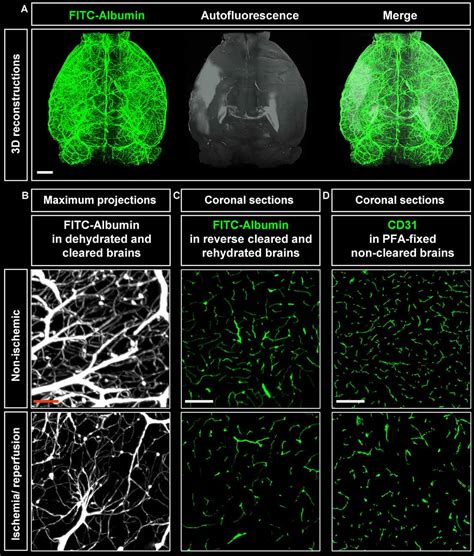 Frontiers Light Sheet Microscopy Using Fitc Albumin Followed By