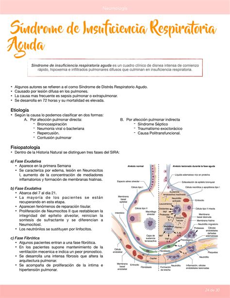 Solution Sdra Sindrome De Dificultad Respiratoria Aguda Studypool