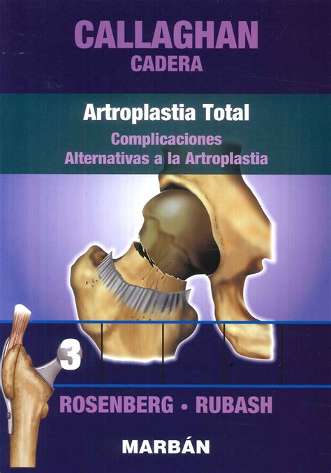 Cadera Tomo Artroplastia Total Callaghan Ediciones T Cnicas Paraguayas