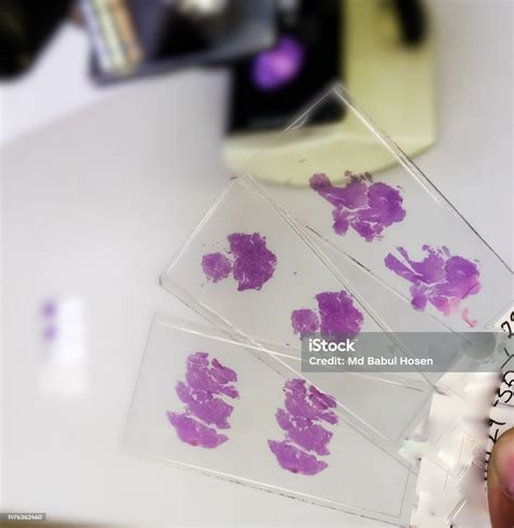 Histopathology Slides Stained With Hematoxylin And Eosin Or He Stain