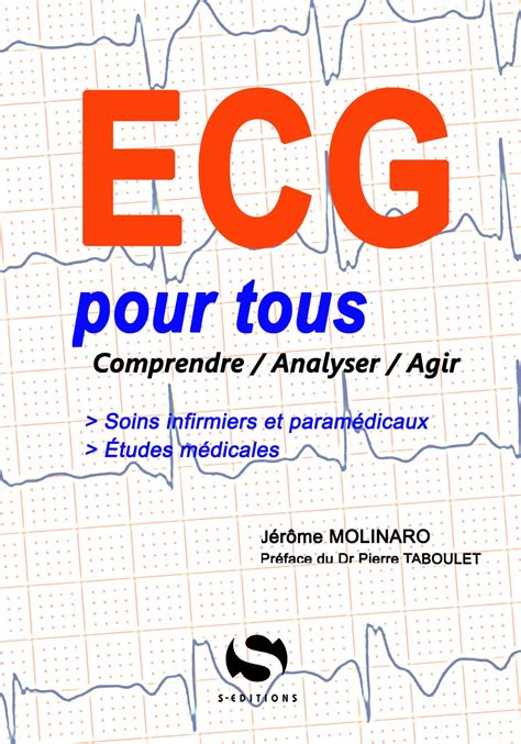 M Thodologie De Lecture Dun Ecg Actualit S Ams Ams Aquitaine