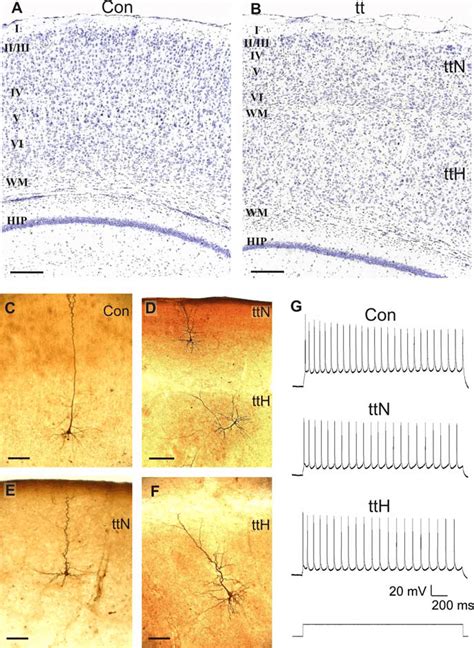 Cellular Morphology And Action Potentials Of Pyramidal Cells In The