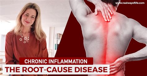 The Root Cause Disease Chronic Inflammation Real Way Of Life