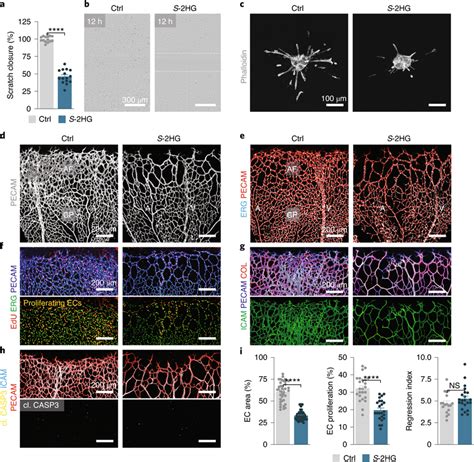 S 2hg Restrains The Angiogenic Activity Of Ecs Ab S 2hg Reduces The Download Scientific