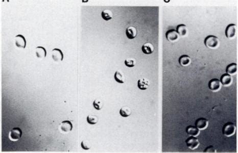 Nomarski interference microscopy. original magnification 900x; current... | Download Scientific ...