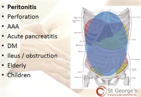 Abdominal Pain Flashcards Quizlet