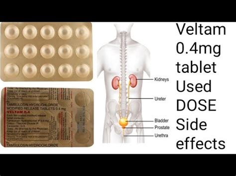 Veltam 0.4mg tablet uses in Bengali language// Used Dose and side ...