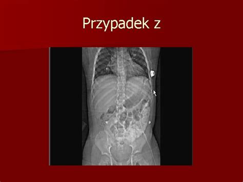 Diagnostyka Przewodu Pokarmowego Grny Odcinek Przewodu Pokarmowego Metody