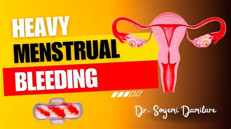 Heavy Menstrual Bleeding Causes And Treatment Heavyperiods Heavymenstrualbleeding Youtube