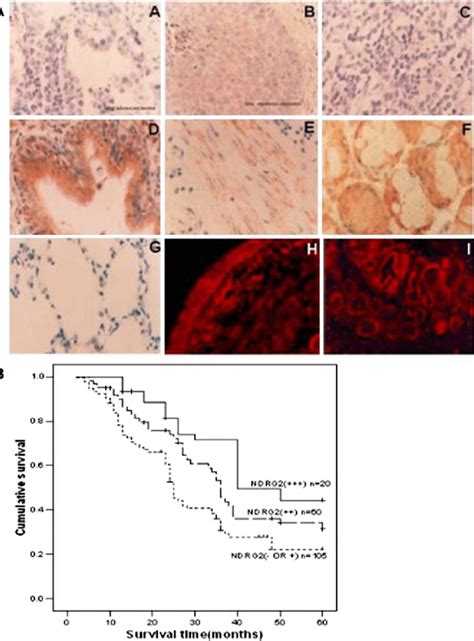 Ndrg Expression In Lung Cancer And Normal Lung Tissues A Ihc Staining