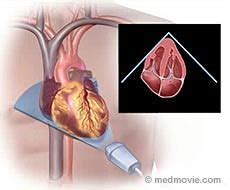 Heart Ultrasound | See My Heart American Society of Echocardiography