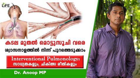 Interventional Pulmonology സാധ്യതകളും ചികിത്സ രീതികളും Dr Anoop Mp