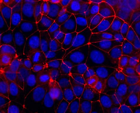 Occludin Antibody Cl Proteintech