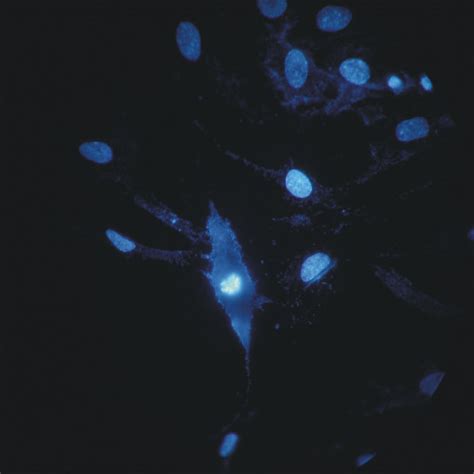 Immunofluorescence Expression Of P53 In Cell Cultures Obtained From