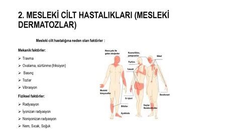 Meslek C Lt Hastaliklari Ppt Indir