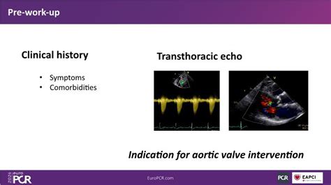 Expanding The Heart Team Improved TAVI Outcomes Through Pre And Post