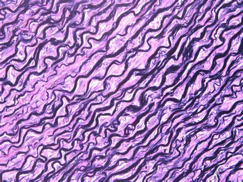 Diagram Diagram Of Elastic Tissue Mydiagramonline