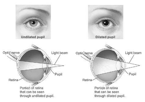 Dilated And Undilated Pupil Eye Health The Retina Eyes National