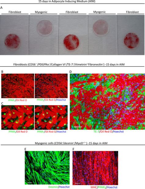 Human Muscle Derived CD56 TE 7 Fibroblasts And CD56 Desmin