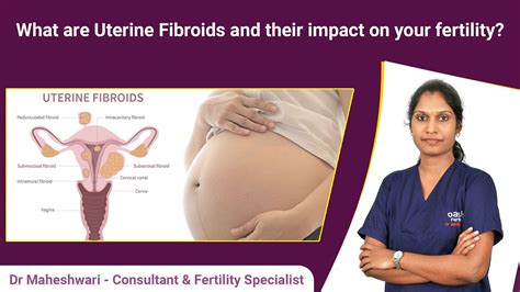 What Are Uterine Fibroids And Their Impact On Your Fertility Dr