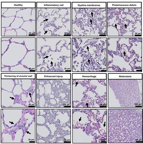 A Semi Quantitative Scoring System For Green Histopathological