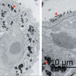 TEM Images Of Differentiated THP 1 Cells After Being Exposed To Nd 3