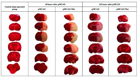 Representative Ttc Stained Brain Sections From Each Group The Infarct