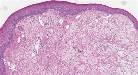 Vocal Cord Histology