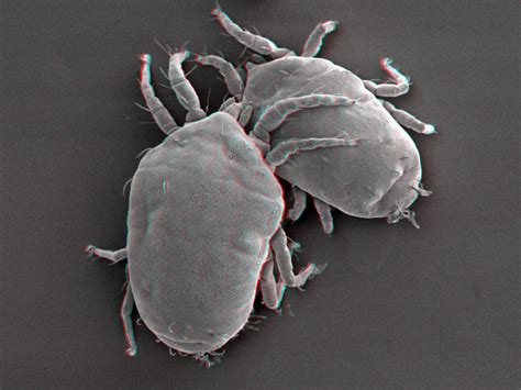 Scanning Electron Microscopy (SEM) - Consistence