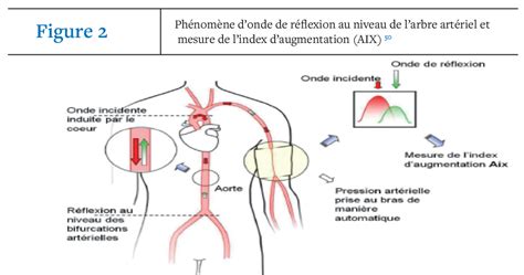 Vue de Rigidité artérielle et HTA Revue Algérienne de Médecine Interne