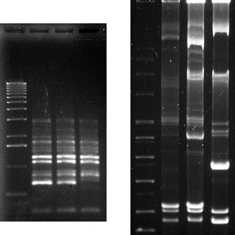 A Fingerprinting Using Rep Pcr B Plasmid Patterns Lanes