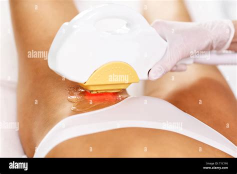 Picture Of Beautician Giving Epilation Laser Treatment To Woman On Bikini Stock Photo Alamy