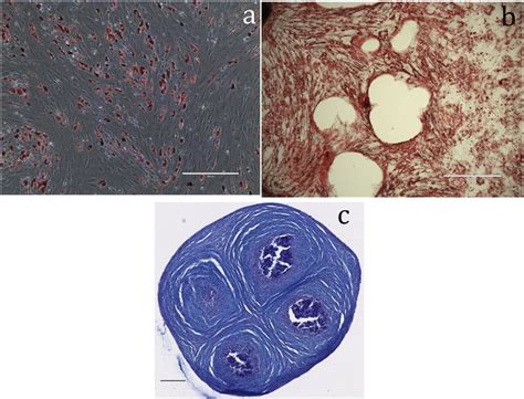 Adipose Derived Stem Cells Differentiated Into Adipocytes Showing Oil