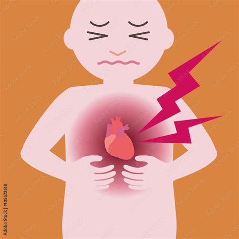 Heart Infarction Cardiac Infarction Myocardial Infarct Image