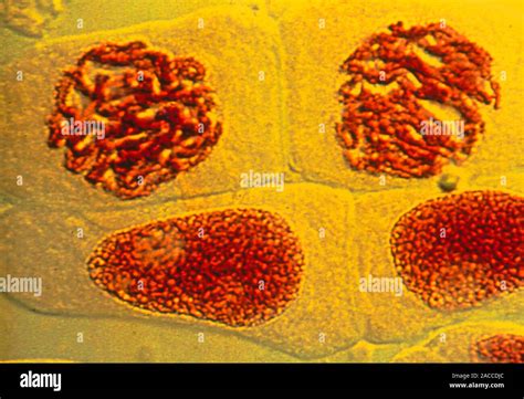 Interphaseprophase Of Cell Mitosis Image 1 Of 6 Light Micrograph Of