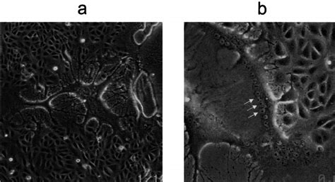 Syncytium Formation In Mv Infected Vero Cells Vero Cells Were Infected Download Scientific