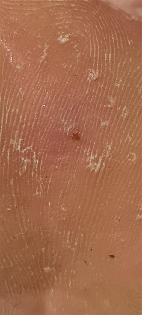 yesterday i wondered why my foot hurt all day long. it was simple