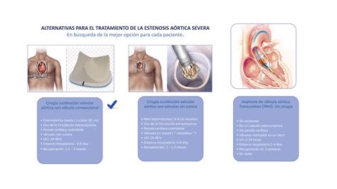 Estenosis Aortica Severa Youtube