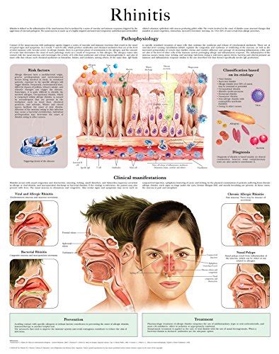 Jp Rhinitis E Chart Full Illustrated English Edition 電子書籍