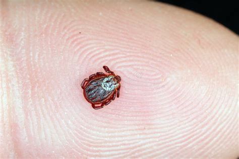 Enfermedad De Lyme Portador Ixodes Tick Dermacentor Marginatus En La