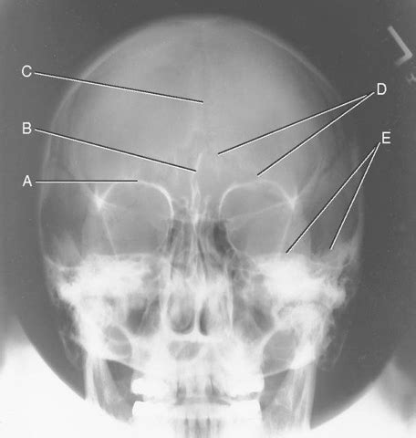 X Ray Anatomy Flashcards Quizlet