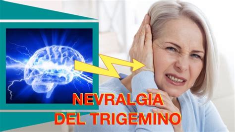 Trigemino Infiammato Cause E Cure Per Il Dolore Ai Denti Actualizado Gennaio 2025