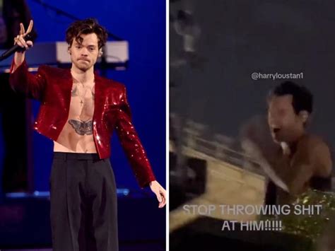 Harry Styles Was Hit In The Face With An Object During His Concert In