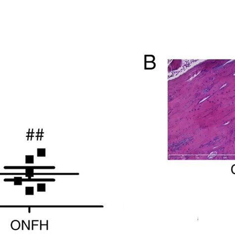 Serum Mir 27a In Onfh Rats A Serum Mir 27a Levels In Onfh Rats And