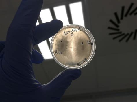 Pure Phytophthora Cultures On V8 Agar Download Scientific Diagram