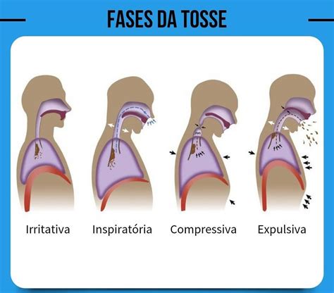 O Que é Reflexo De Tosse BRAINCP