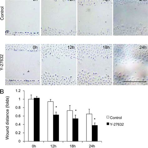 Effects Of Rho Associated Kinase Rock Inhibitor Y 27632 Eye Drops In Download Scientific